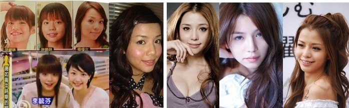 李毓芬不承认整容,变V脸之谜疑似吸脂瘦脸或镭射溶 ...