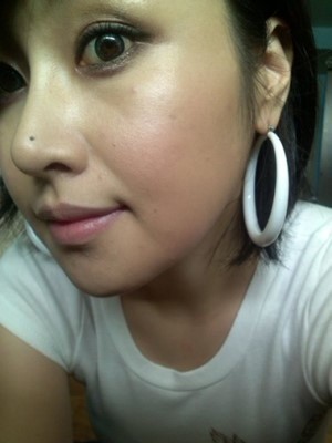 眼皮下垂矫正+棱角下巴矫正+V-LINE瓜子脸+3D回转颧骨+硅胶隆鼻+磨骨矫正鹰钩鼻整形手术后 - 新氧圈子