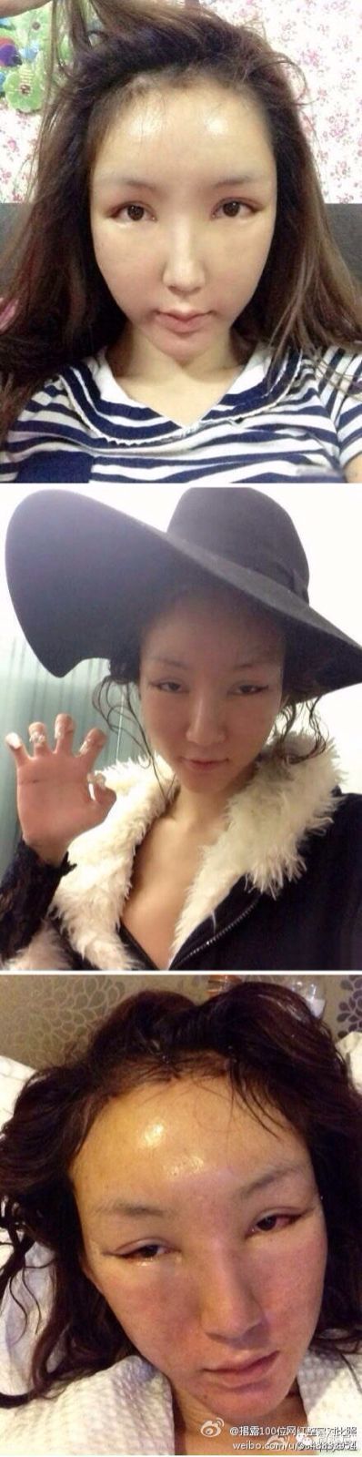 陈怡曼,公开承认整容,居然自曝过程!勇气可佳!不过照片有点恶心.