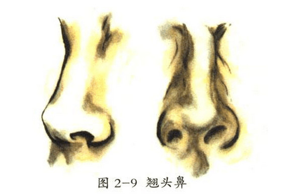 【东方人鼻子的常见形状】