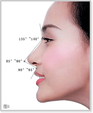 隆鼻rhinoplasty,隆鼻是一种将鼻子的外