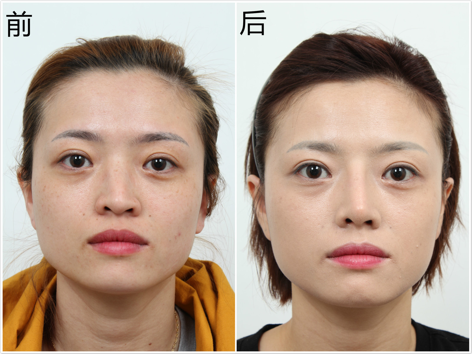 “每天带妆”VS“素脸朝天”的女人，3年之后，皮肤区别很惊人！ - 知乎