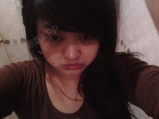 【韩国麦恩MINE整形免费活动】+自卑的_圈子