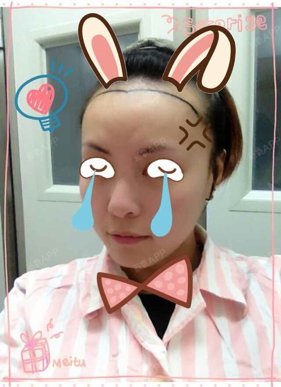 无广告,纯粹分享发际线调整的!,我不在这里推荐