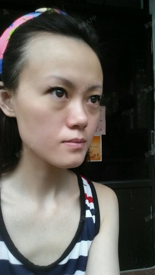 【凯尔整形免费手术】我要我凶悍的内双眼睛变成柔情