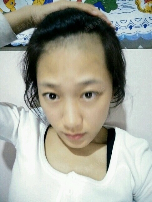 亲们,我想知道做发际线调整多少钱?谢谢啦,今