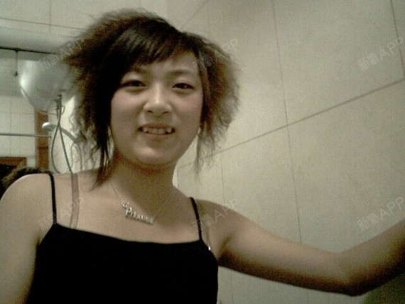 Setlla小晴天埋线双眼皮第112天美丽日记-新氧