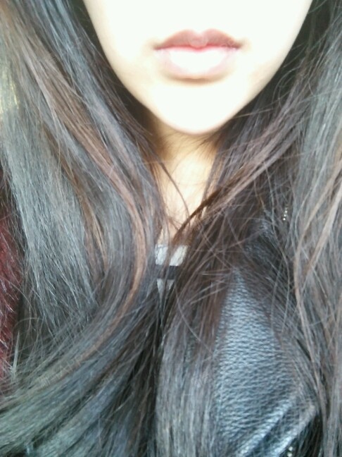 玻尿酸垫下巴四个多月了,睡醒突然肿,以前_圈