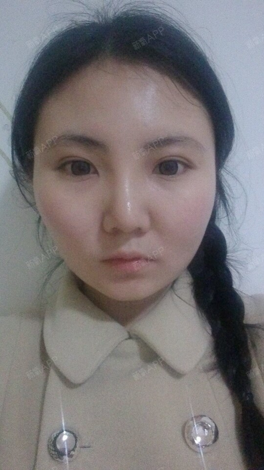 【好像要韩国女生的鹅蛋脸】大家帮忙看看应该