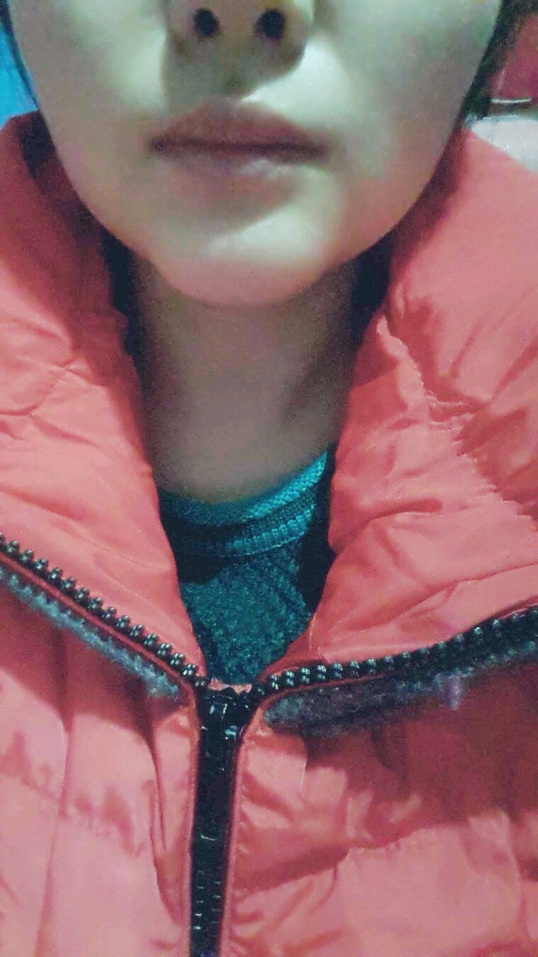 假体隆下巴是不是失败了,已经20天了,还是很丑很突兀.