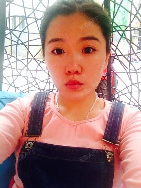 抽脂下巴可行么?视频v抽脂大全下乡杂技图片