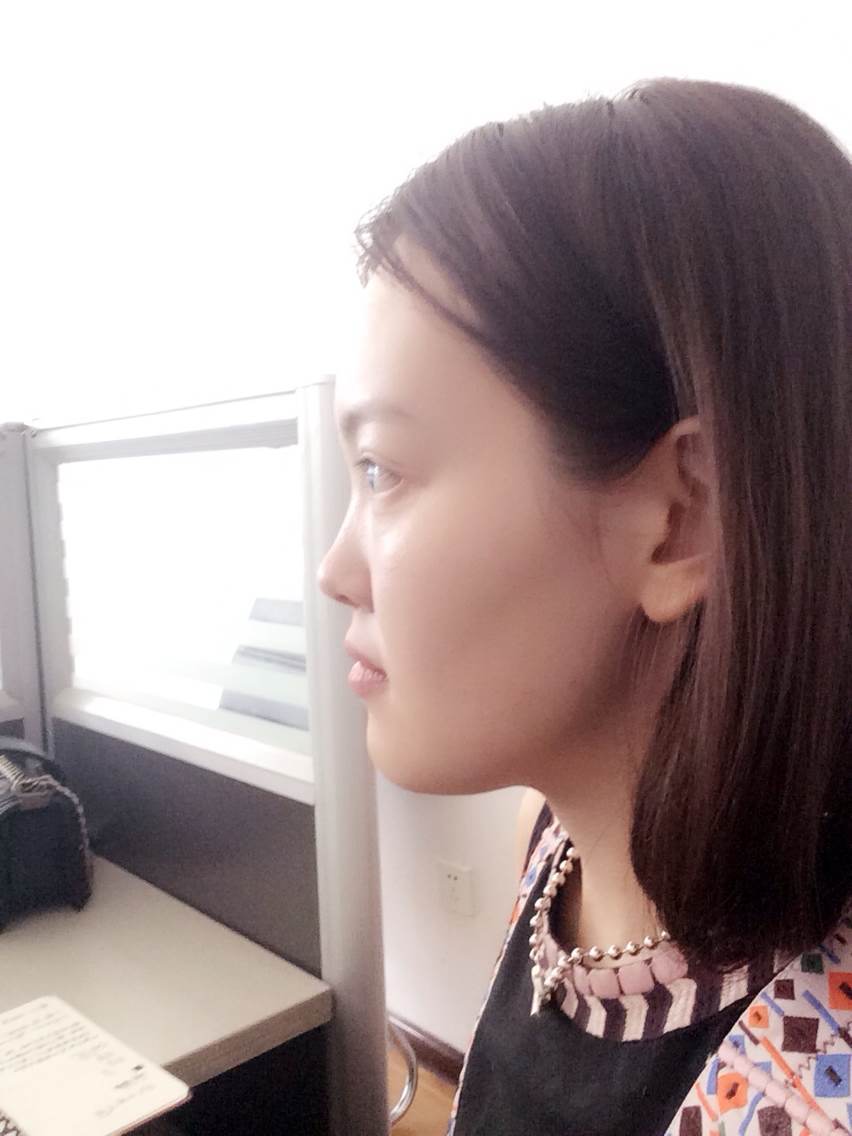 正面,45度,侧面…我就长这个样子了…鼻子小,短,所以看起来脸大.