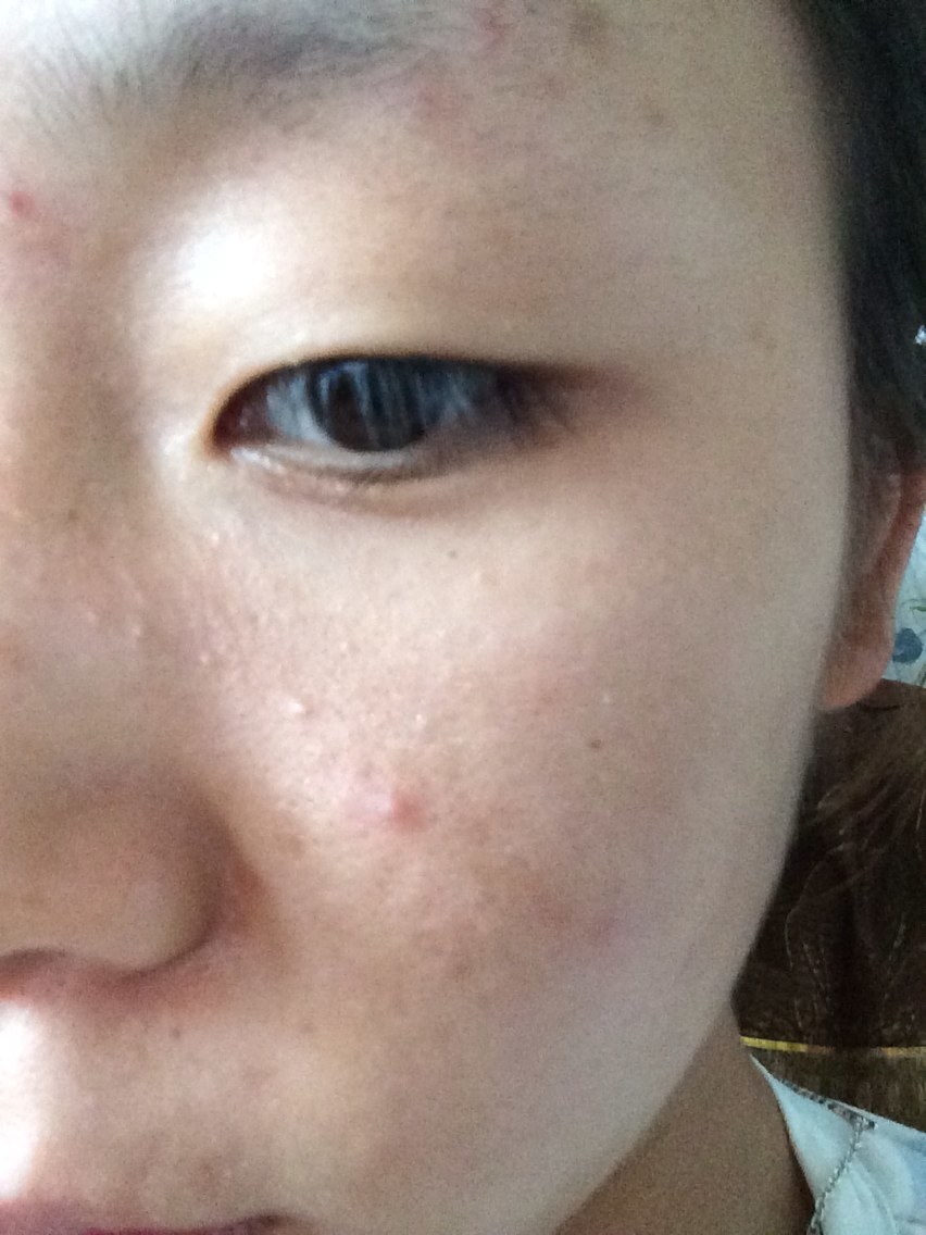 看那个鱼泡眼,鼻子大大的塔塔的