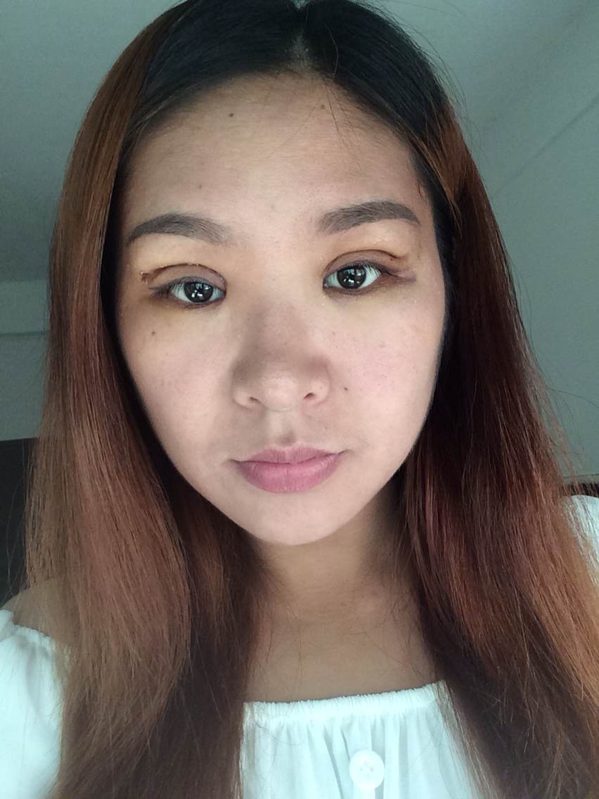 今年好几次突然眼睛模糊看不清楚然后头疼