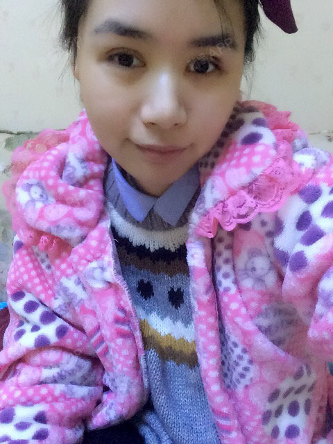 觉得完全不痛啊,就是有点紧张～右眼皮还是紫色的不知道什么时候才消