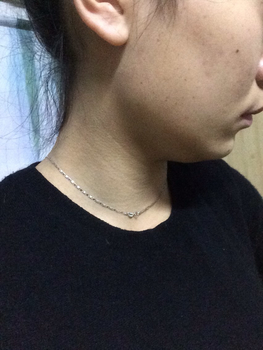 二月份想去成都找李继华教授磨下颚骨,有没有一起的