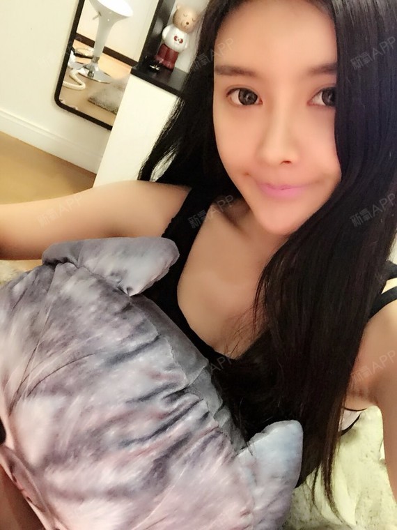 Nana_271934自体脂肪丰额头第3天美丽日记-