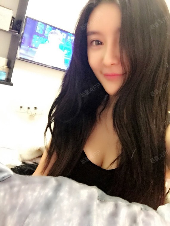 Nana_271934自体脂肪丰额头第3天美丽日记-