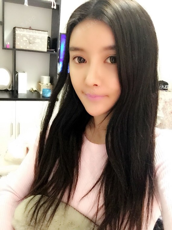 Nana_271934自体脂肪丰额头第3天美丽日记-