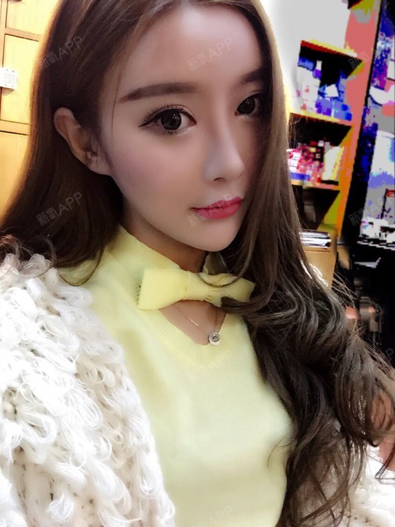 Nana_271934自体脂肪丰额头第39天美丽日记