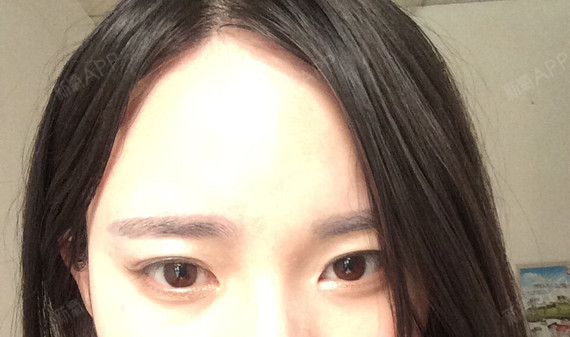 梨花姬半永久纹眉第7天美丽日记-新氧美容整形