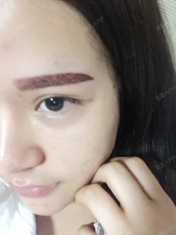 挺好的,就是很肿,刚开始看不习惯
