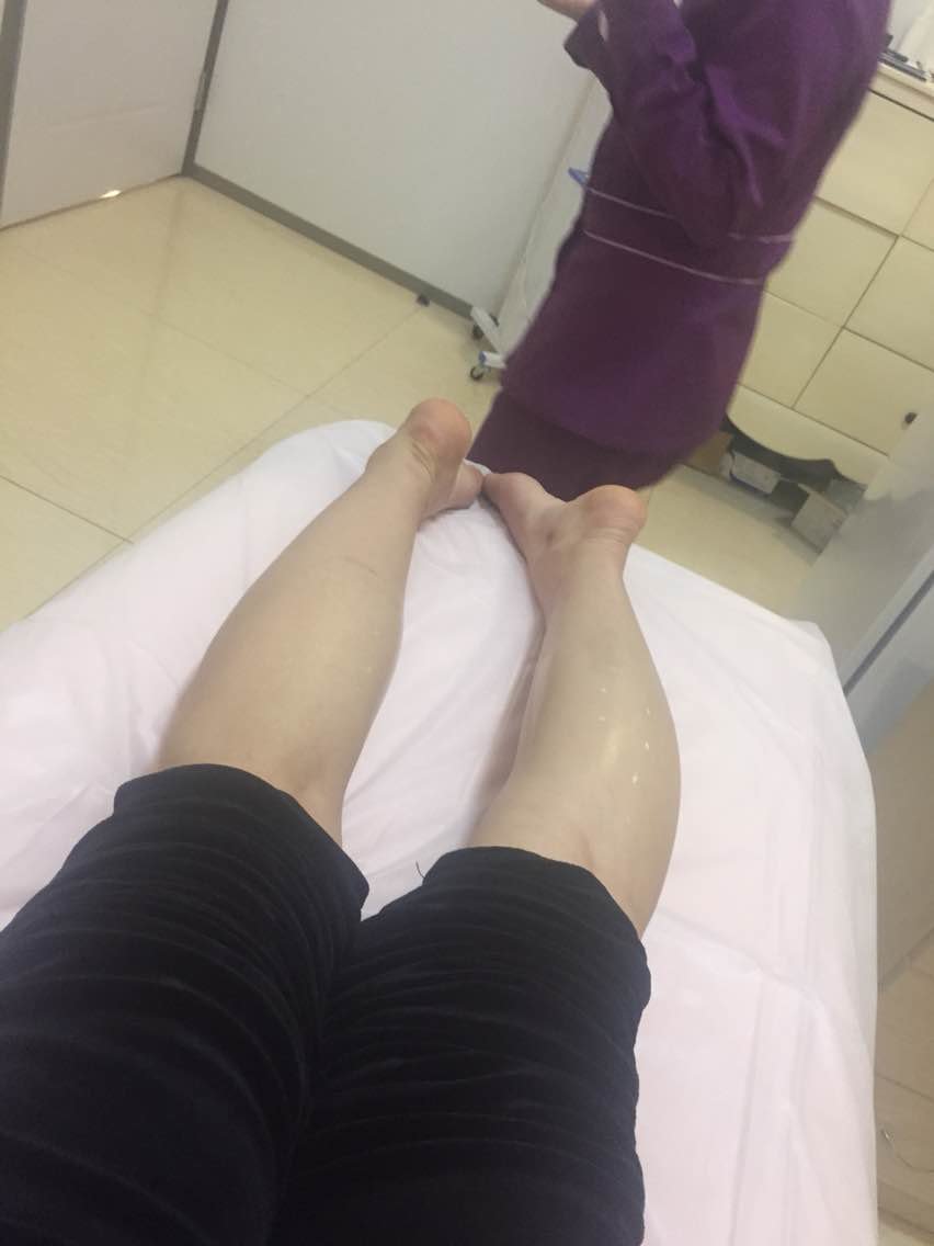 新氧- 图图631888 | 术后当自强 | 注射肉毒素瘦小腿