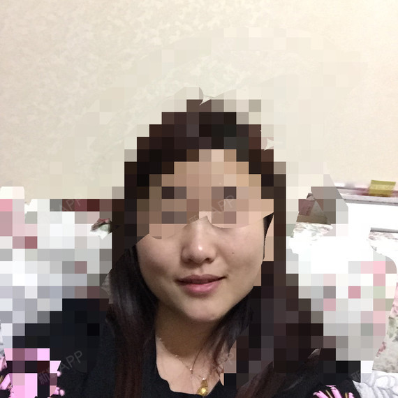 今年27岁,两年前打了2次瘦脸针,现在肉已经完