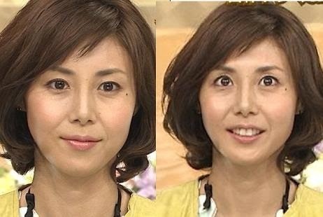 进来说说整容的日本明星吧