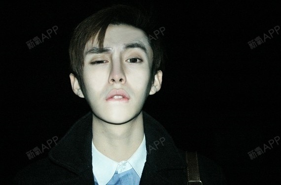 【闲聊】+轰叔廖劲锋整容后好帅