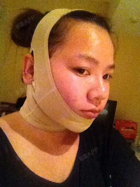 北京八大处整形医院《面颈部激光溶脂》活动。