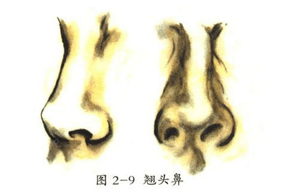【东方人鼻子的常见形状】1平实鼻:此类型的鼻