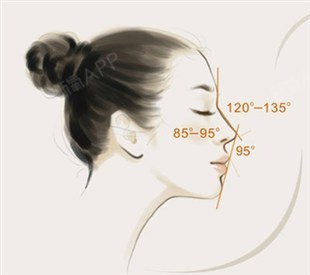 北京丽星整形Misko隆鼻理念Misko韩式4D隆