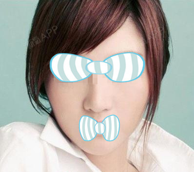 无锡微针美塑多久做一次?随着医疗技术的进步