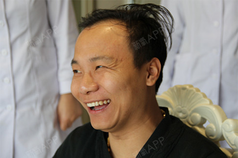 北京博士园毛发研究中心毛囊单位移植第0天美
