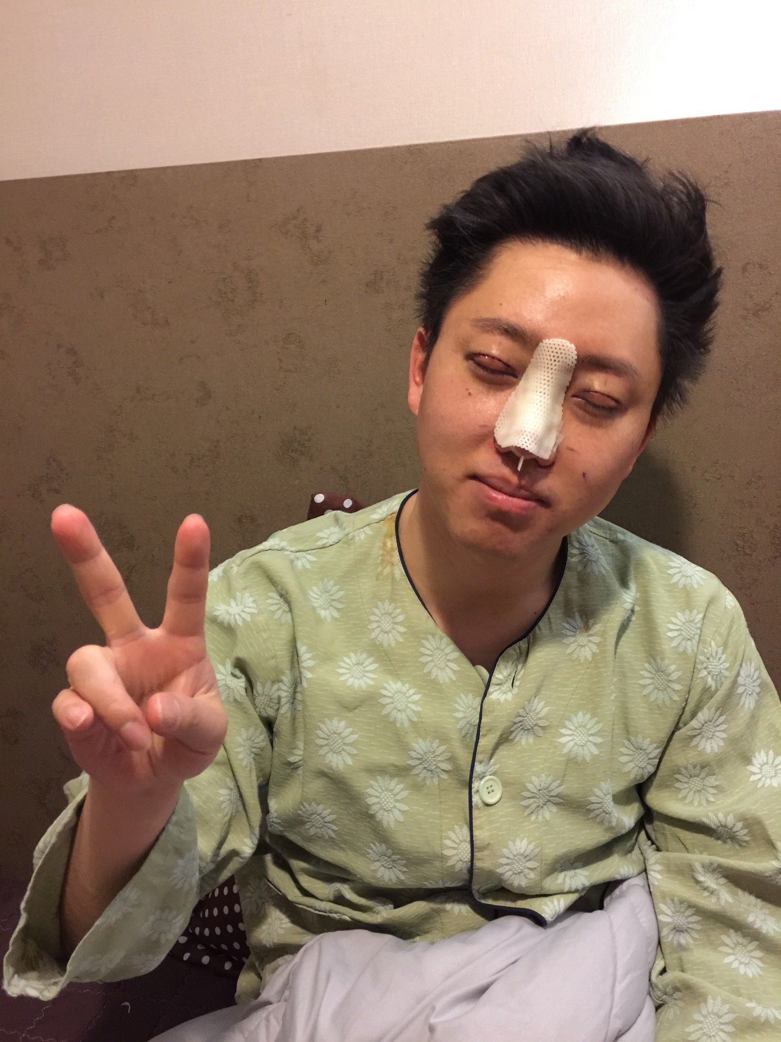 大家都说我是福鼻会招钱,但是鼻头大,显得笨拙.