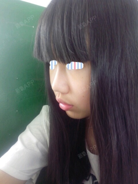 求各位氧气帮我看看嘴巴应该怎么办好翘好丑