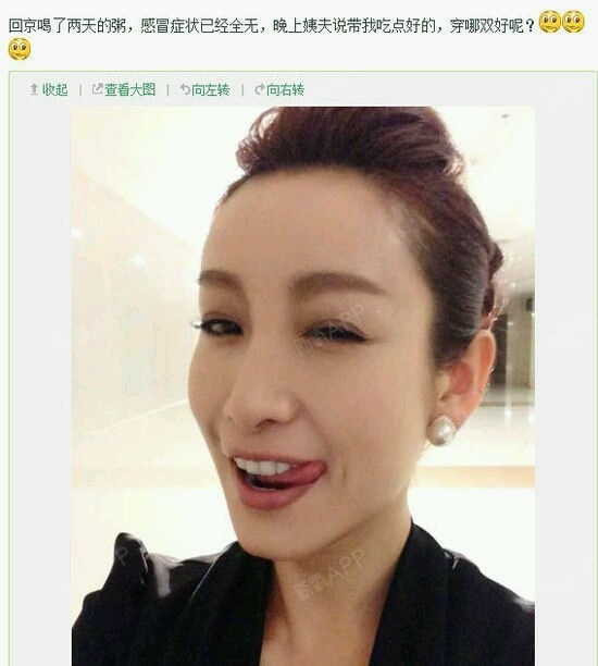 最近看红高粱,发现秦海璐的鼻子假体很明显,额头也是凸的真是有点夸张