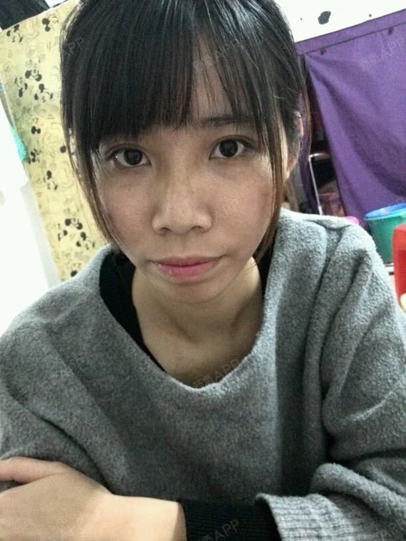 的很立体,昨天今天肿得皮都绷亮了2015年1月0杨默默momo是的呢我现在