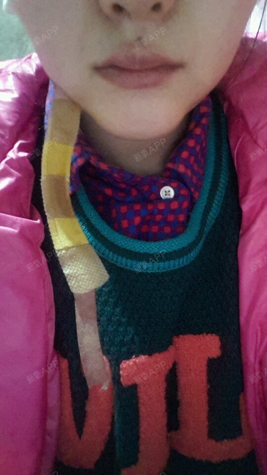 大家看我下巴是不是做失败了,左右有凹凸,_圈子-新氧美容整形