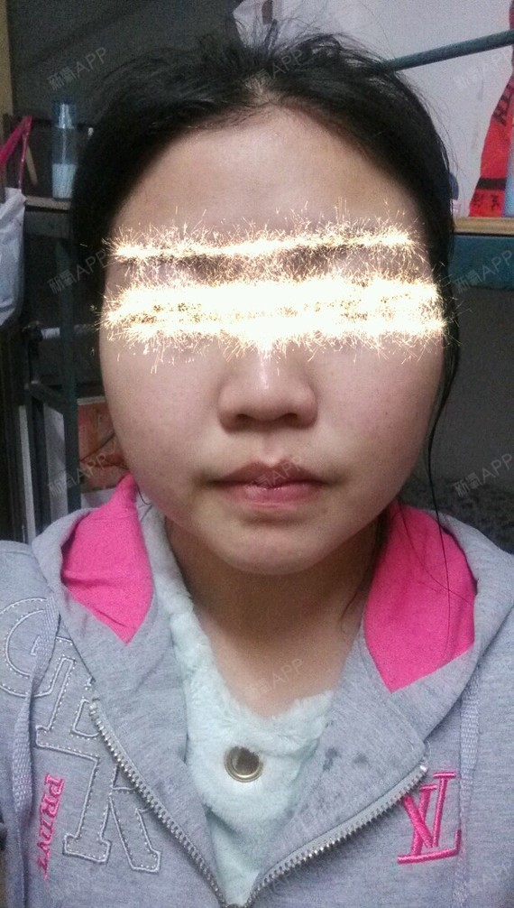 第5天了细腻了许多