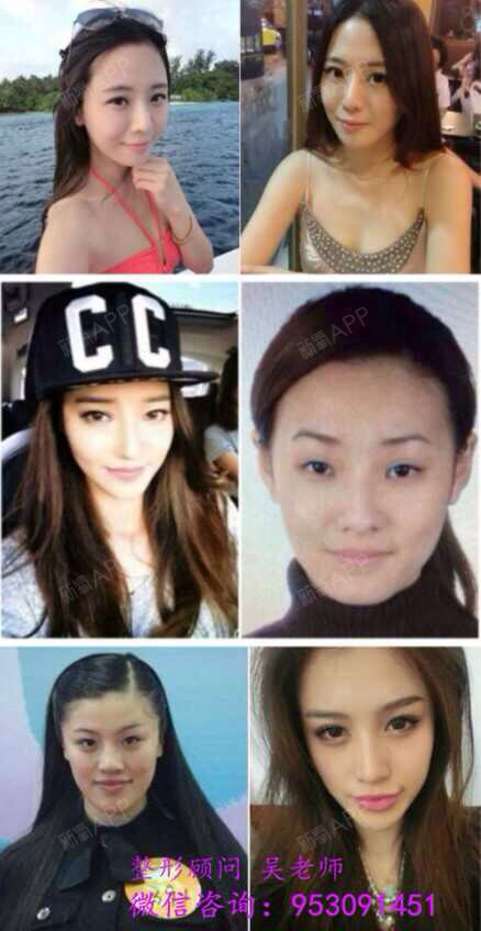 陶喆公布结婚 妻子江姵蓉被疑整容 欧弟公布结婚 娇 圈子 新氧美容整形