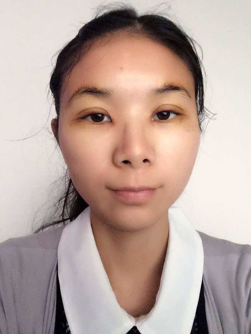 新氧- 由子 | 术后当自强 | 开内眼角 | 国内整形
