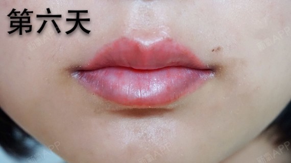 因为我是第一次漂唇所以不知道是不是这样,我也只能慢慢等了,一个月后