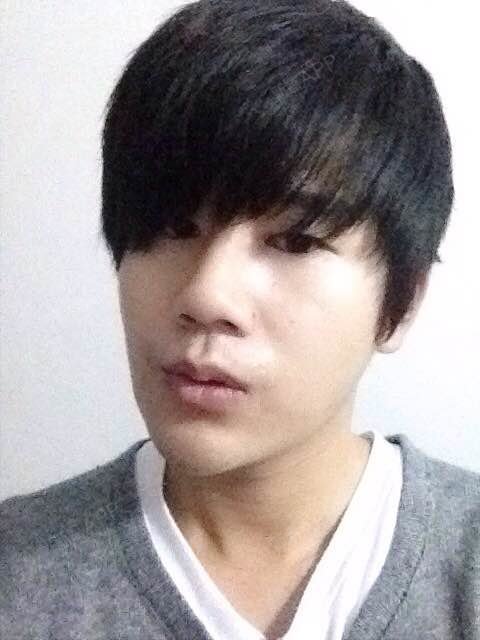 新氧- 玄俊恋情 | 术后当自强 | 玻尿酸垫下巴