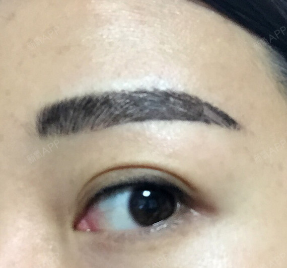 眉毛开始结痂掉痂了,看起来裂成一块一块的,丑.