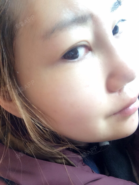 我终于有鼻梁了!