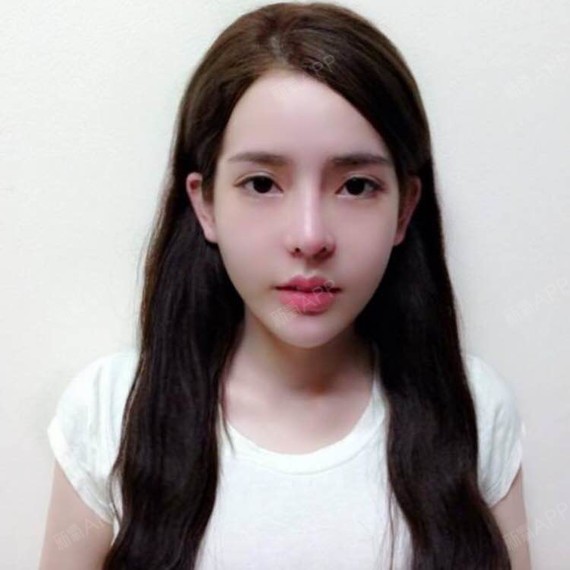 全脸整容前后对比!根本不像一个人好吗!一直很_圈子-新氧美容整形