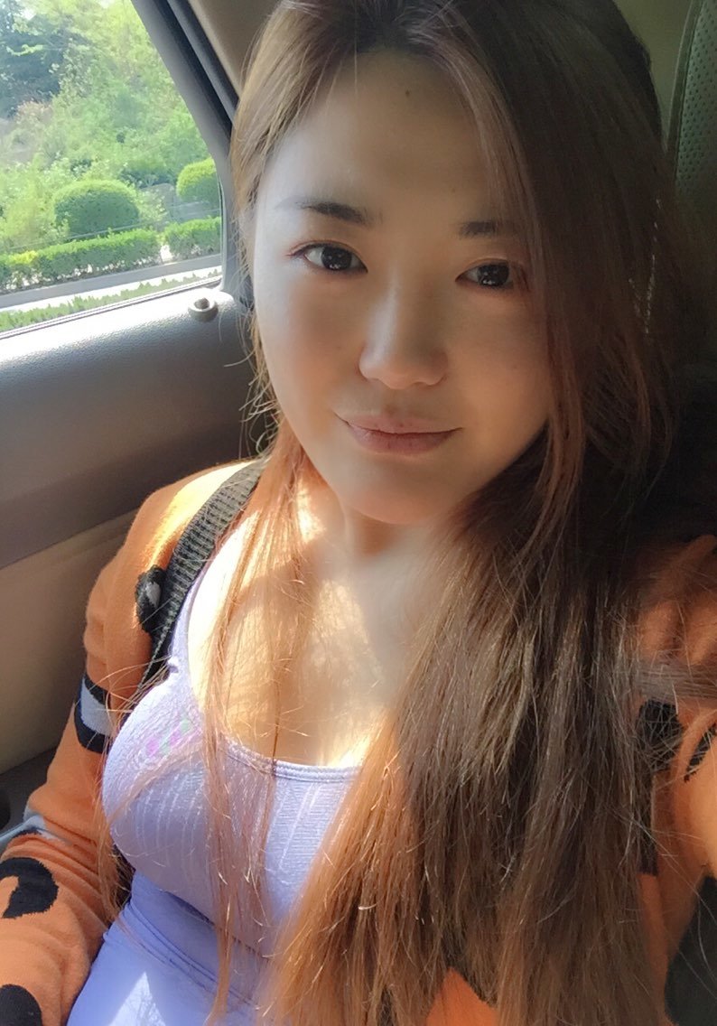 好不好_效果图_郑经人术后第天_新氧美容整形