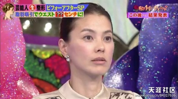 没事逛天涯的我 看到的强悍贴 这是崇拜芭比娃娃 圈子 新氧美容整形